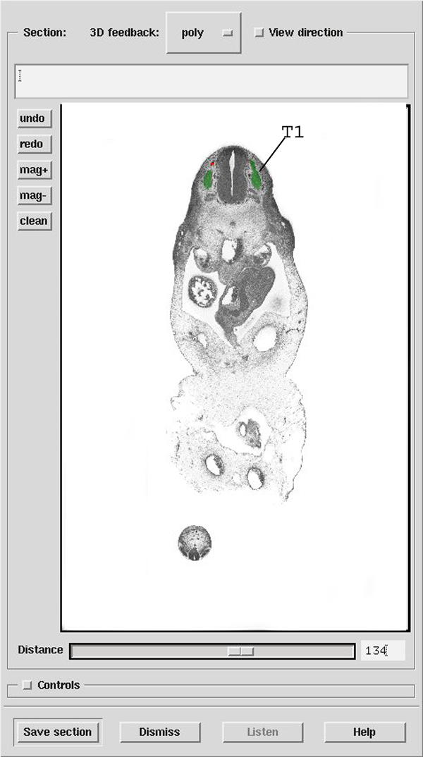 A 3D model of a human embryo