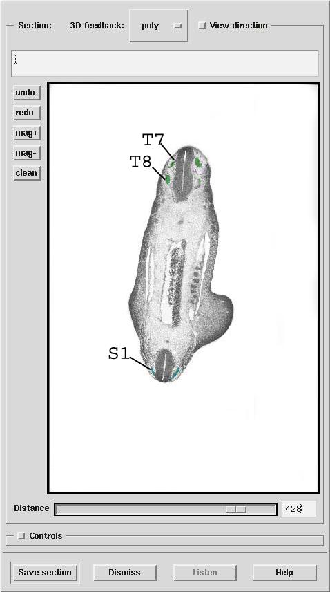 A 3D model of a human embryo