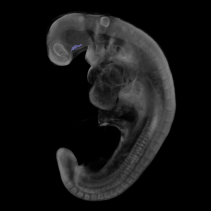 3D model of the human embryonic gastro-intestinal tract