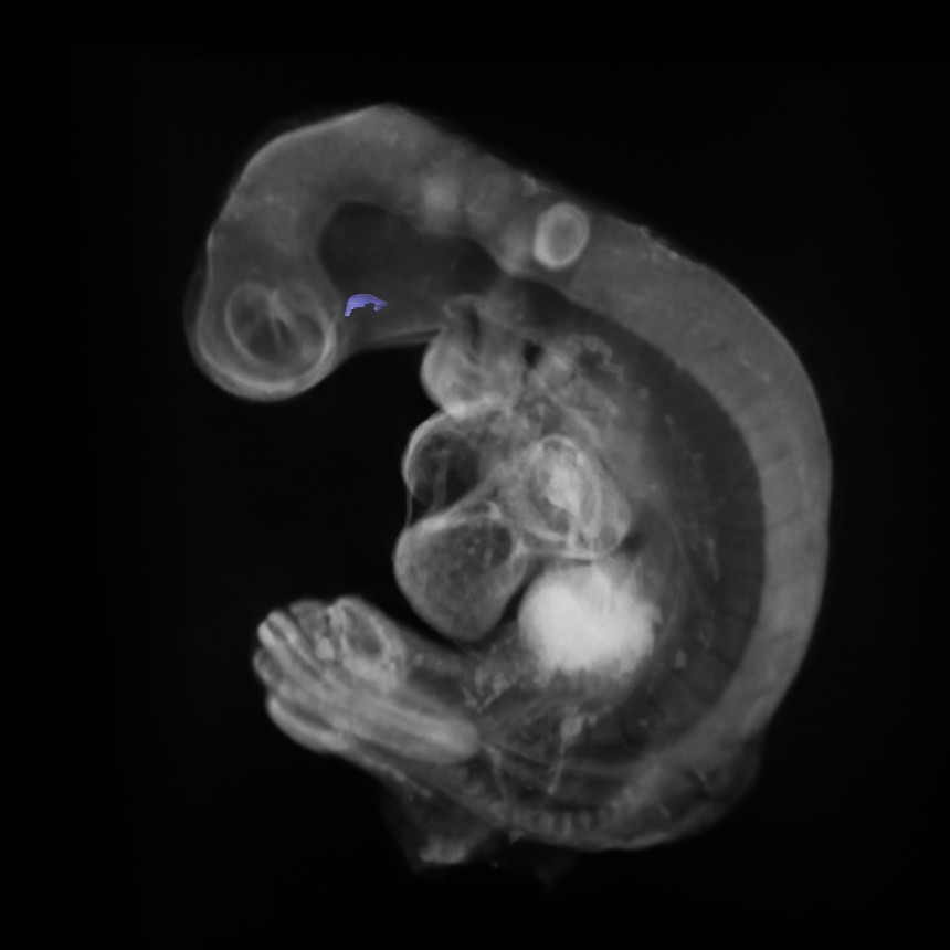 3D model of the human embryonic gastro-intestinal tract