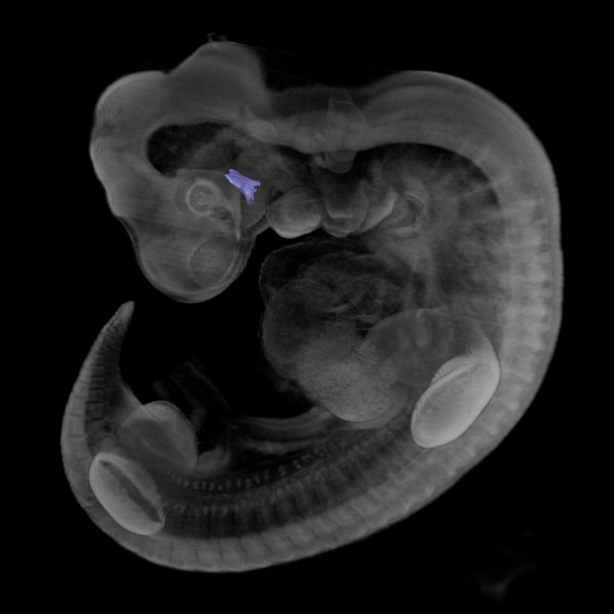 3D model of the human embryonic gastro-intestinal tract