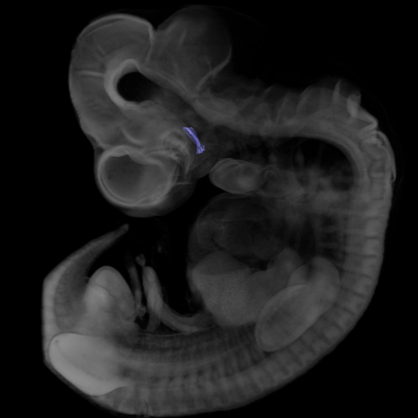 3D model of the human embryonic gastro-intestinal tract
