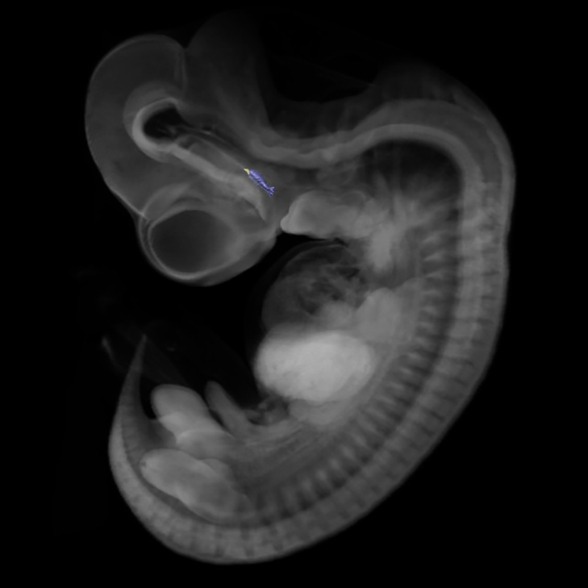 3D model of the human embryonic gastro-intestinal tract