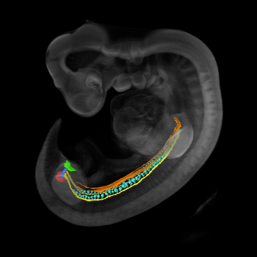 3D model of a human embryonic brain