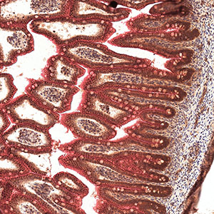 Gene expression in a human fetus