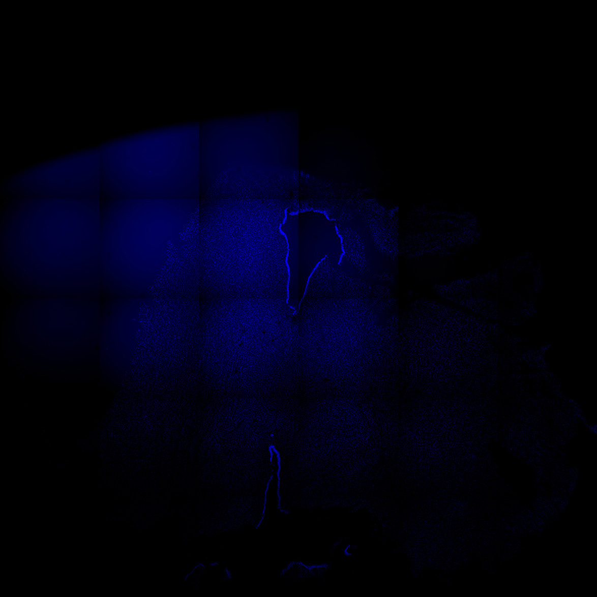 Human foetal midbrain