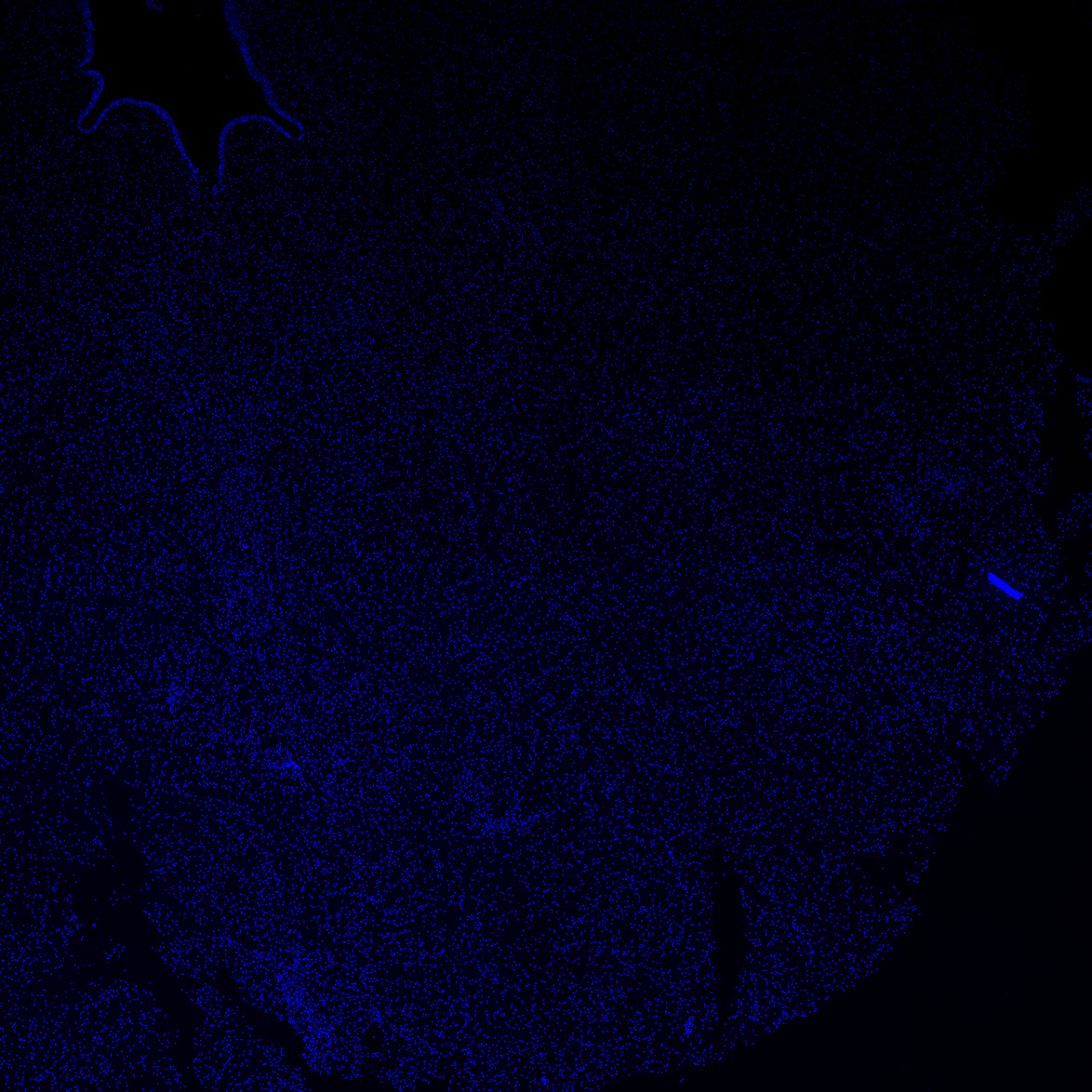 Human foetal midbrain