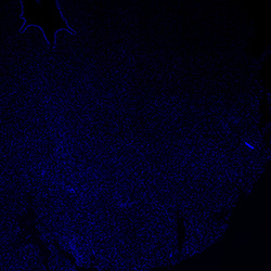 11PCW human midbrain