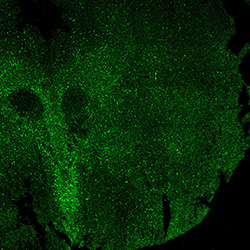 11PCW human midbrain