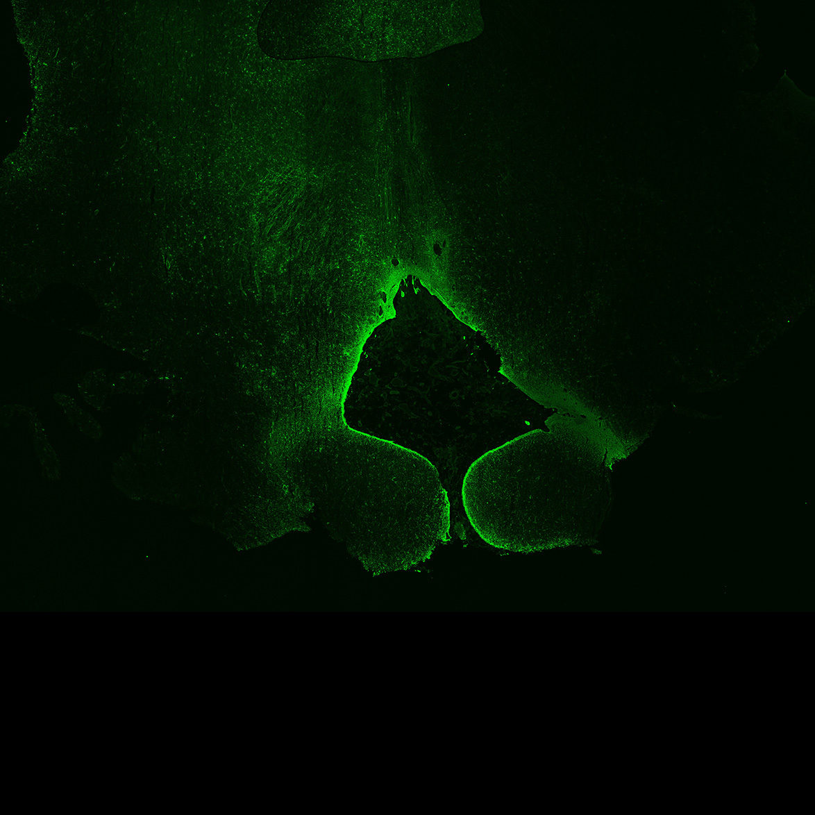 Human foetal midbrain