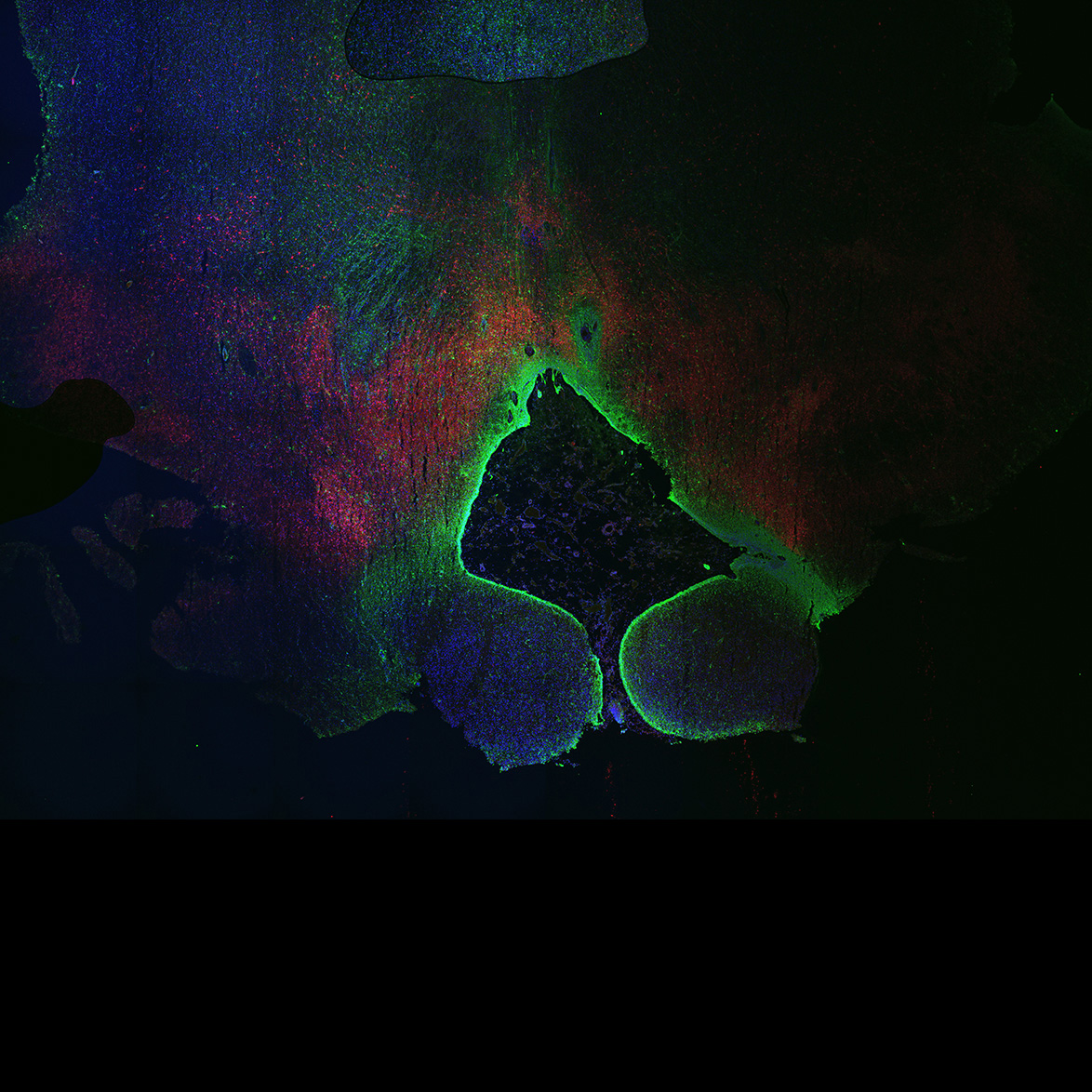 Human foetal midbrain