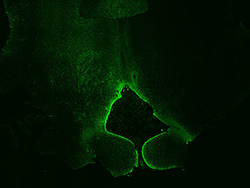 19PCW human midbrain