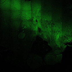 19PCW human midbrain