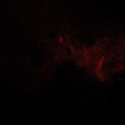 19PCW human midbrain