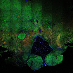 19PCW human midbrain