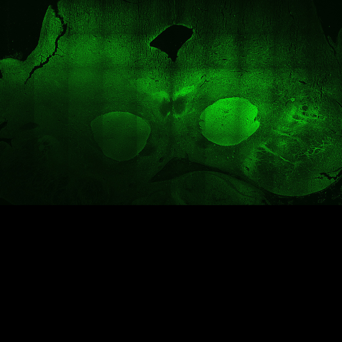 Human foetal midbrain