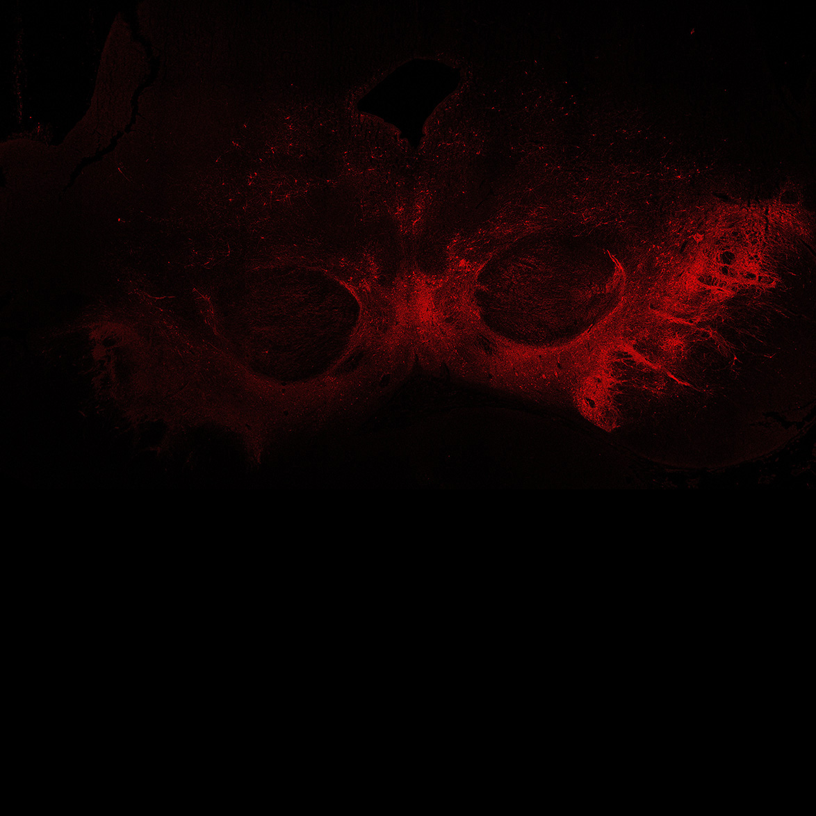 Human foetal midbrain