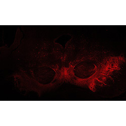 22PCW human midbrain