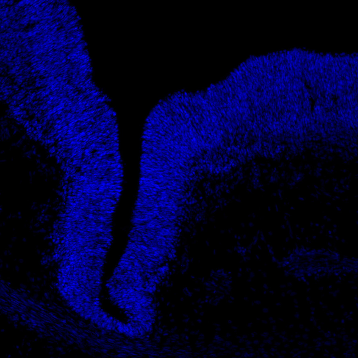 Human foetal midbrain
