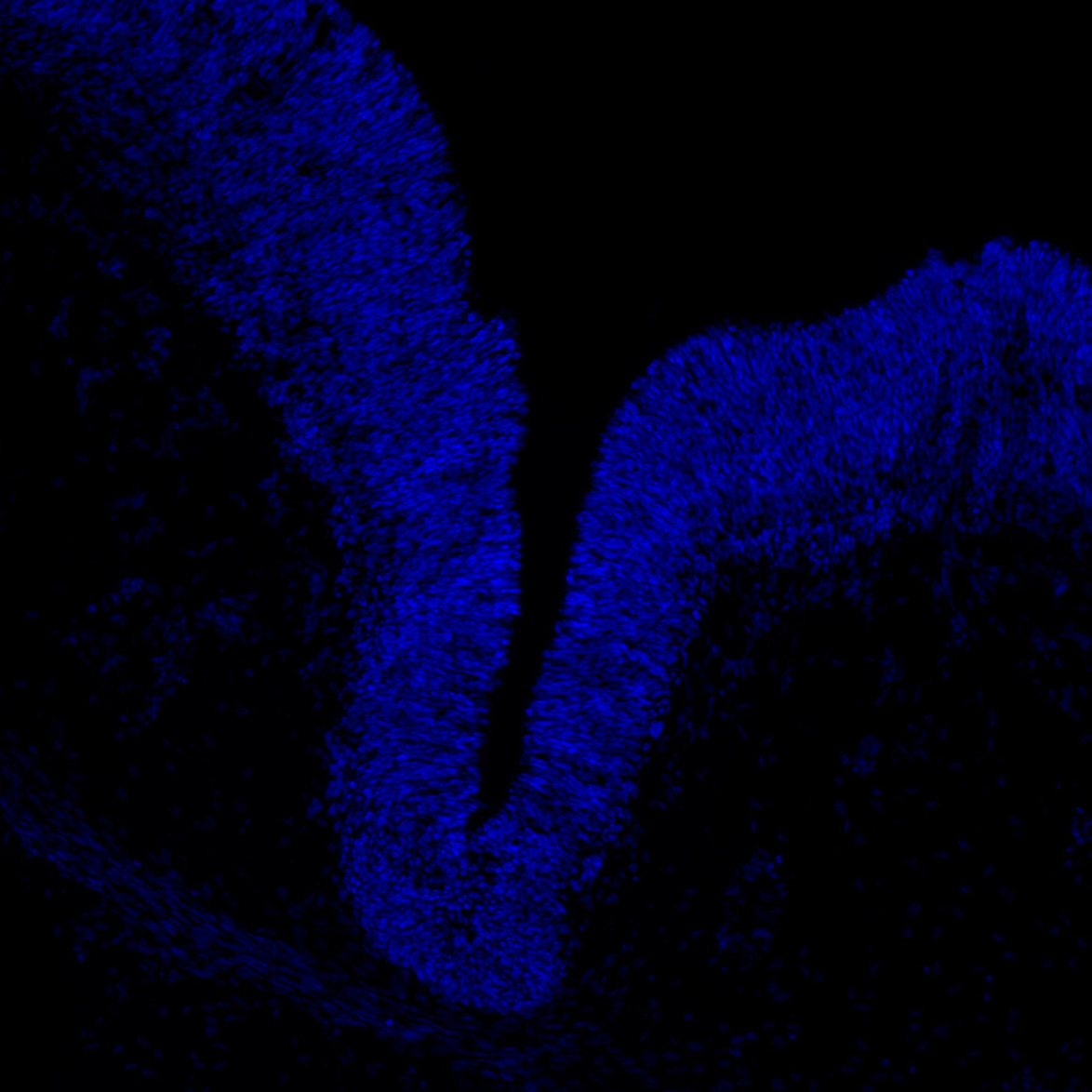 Human foetal midbrain