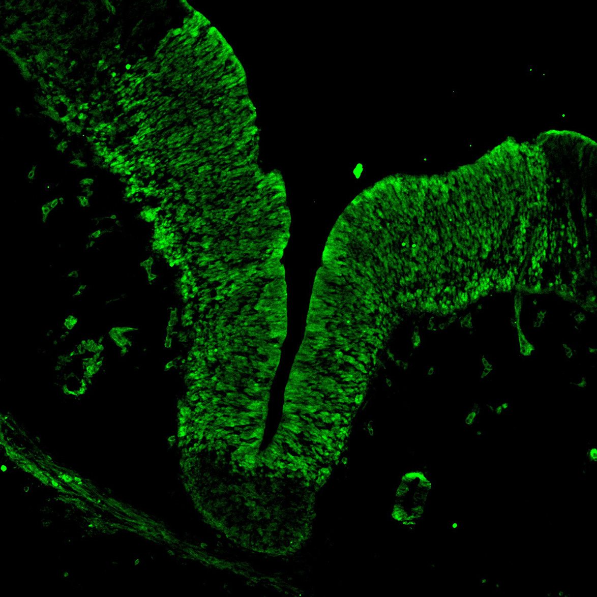 Human foetal midbrain