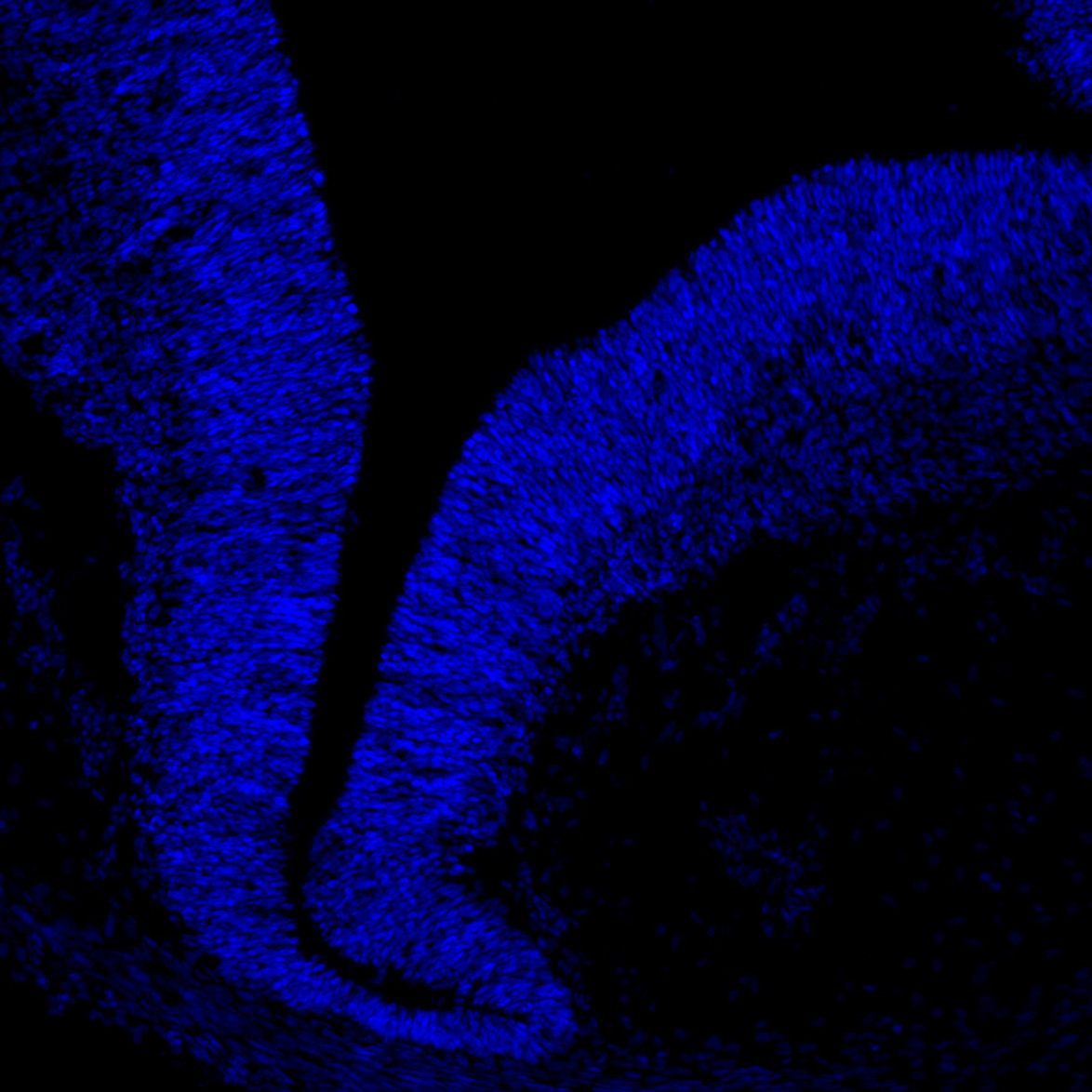 Human foetal midbrain