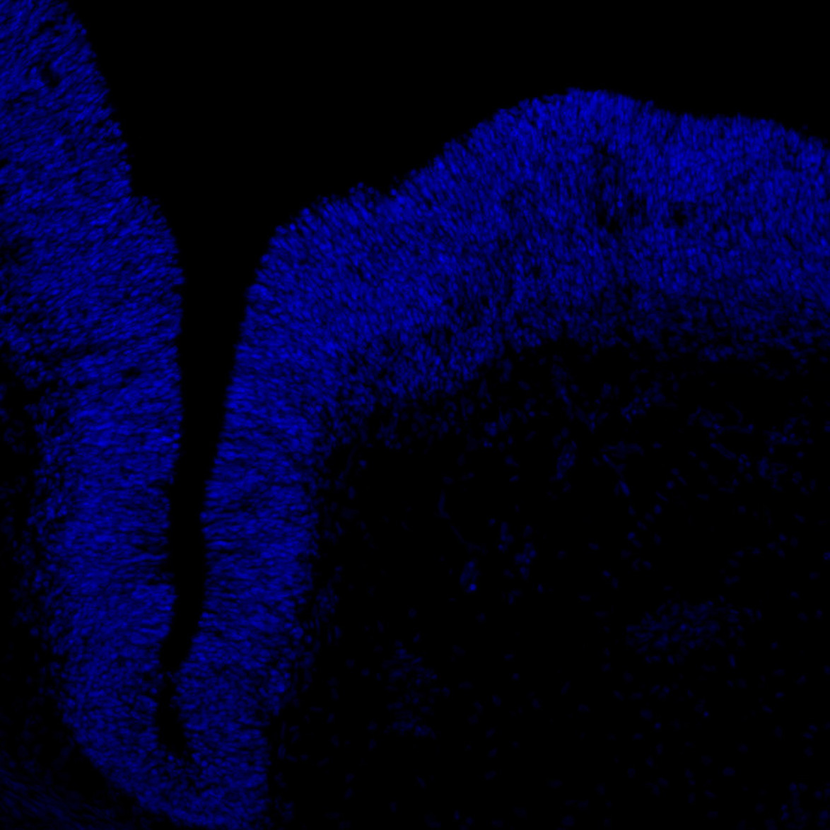 Human foetal midbrain