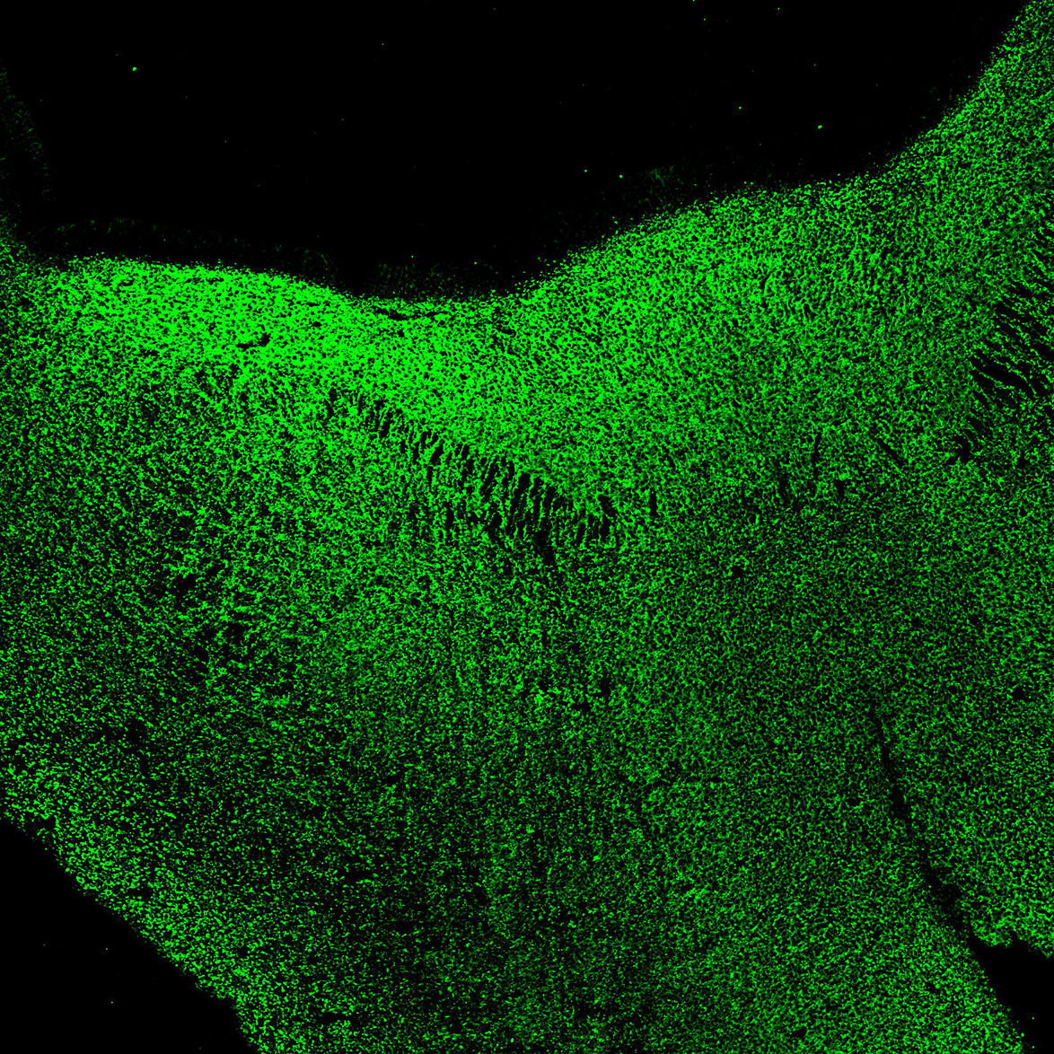 Human foetal midbrain