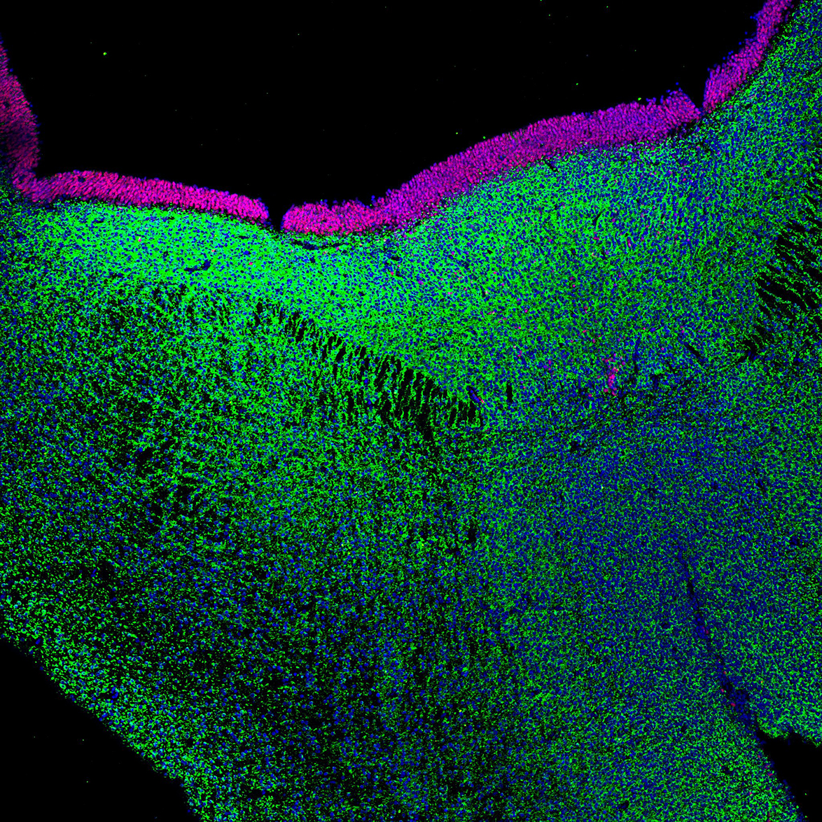 Human foetal midbrain