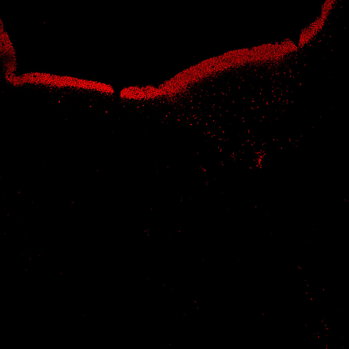 Human foetal midbrain