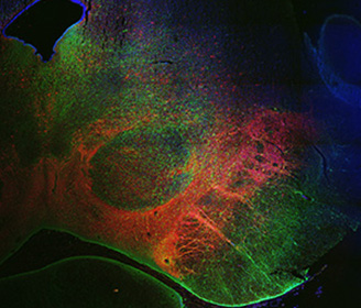 A 3D model of a human embryonic brain
