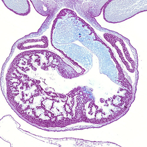 Alcian blue PAS section of a human embryo