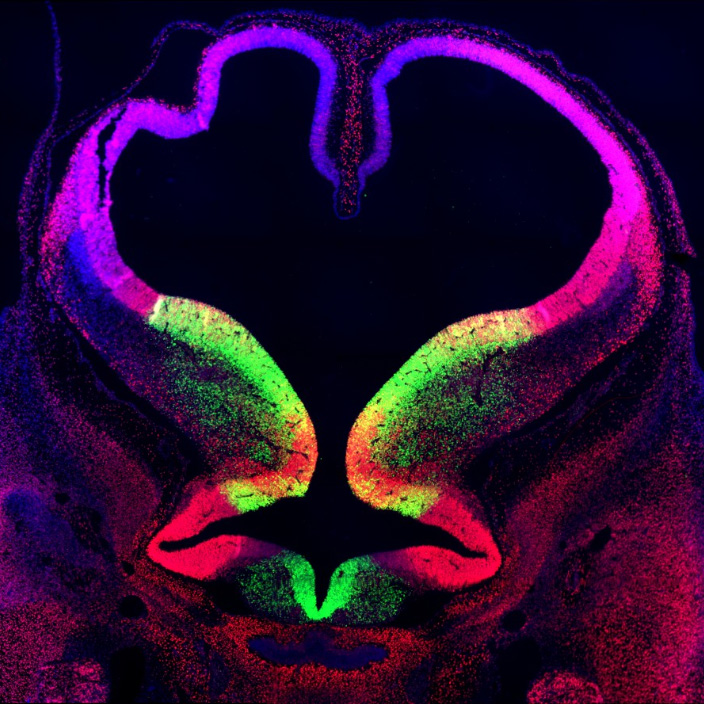 Section of a human embryonic brain