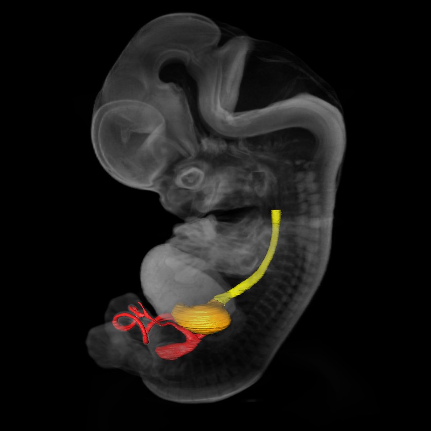 3D model of a human embryo