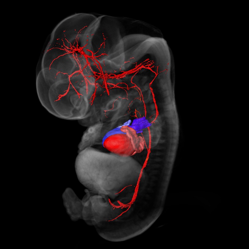 3D model of a human embryo