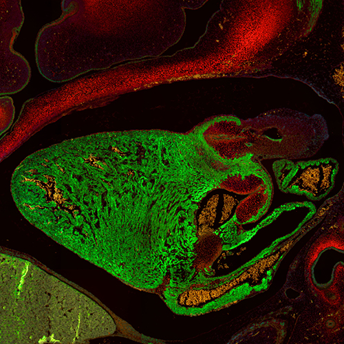 Human embryonic cardiovascular system