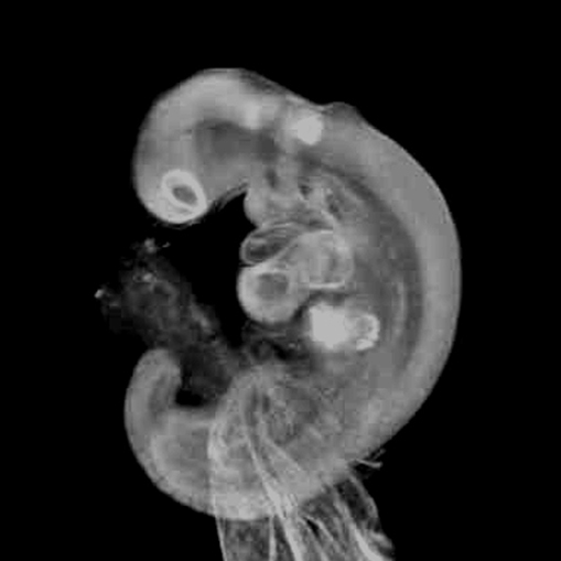 A human embryo 