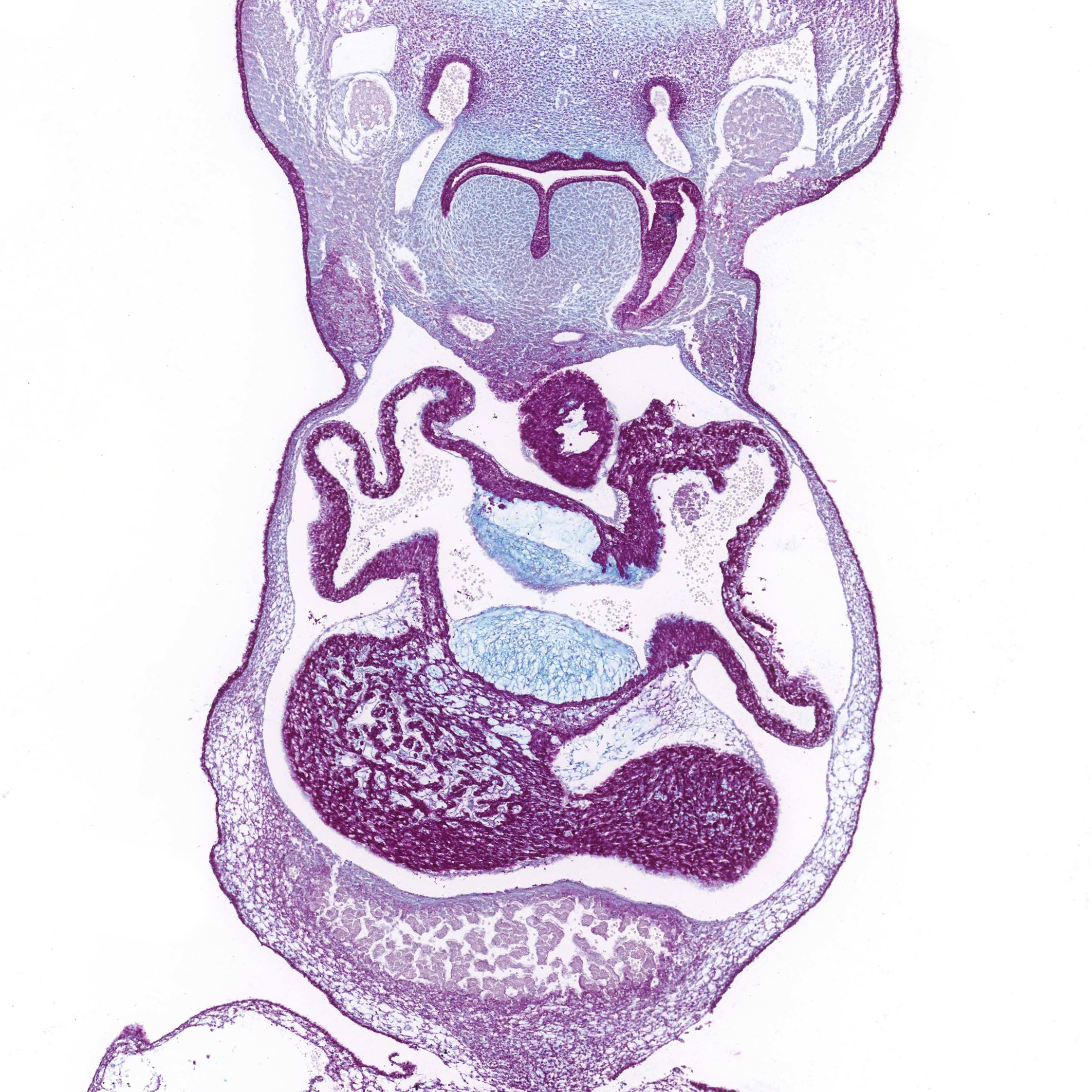 Alcian blue PAS section of a human embryo