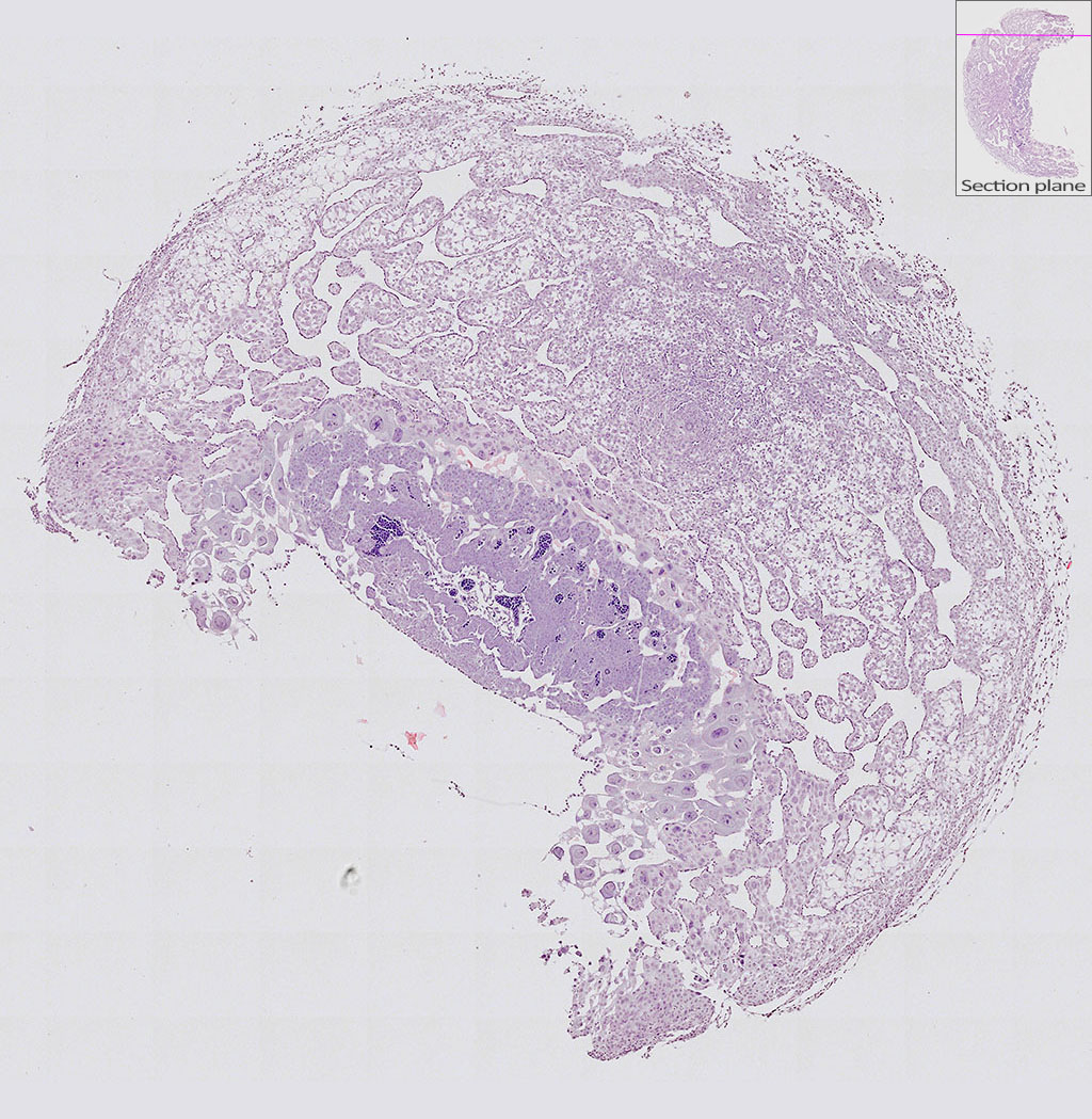 e9.5 mouse placenta