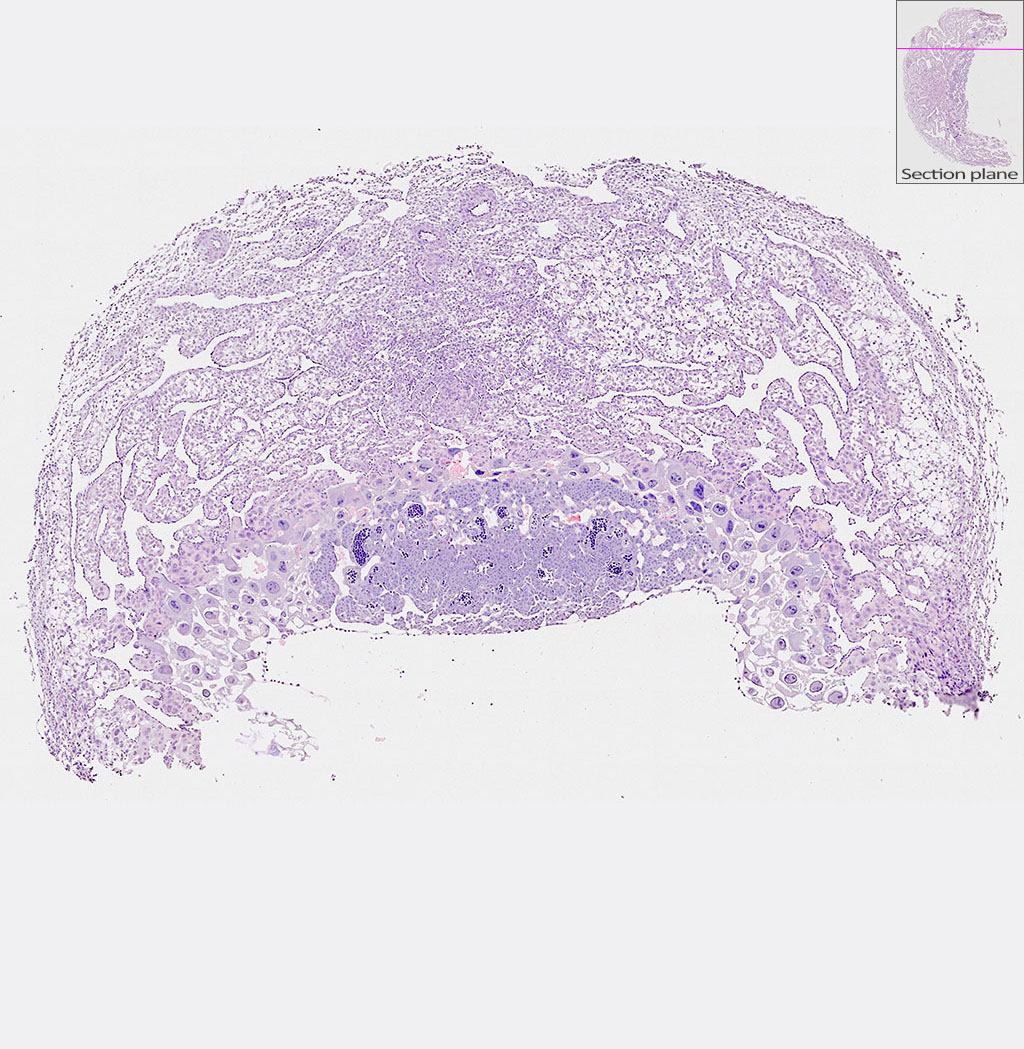 e9.5 mouse placenta