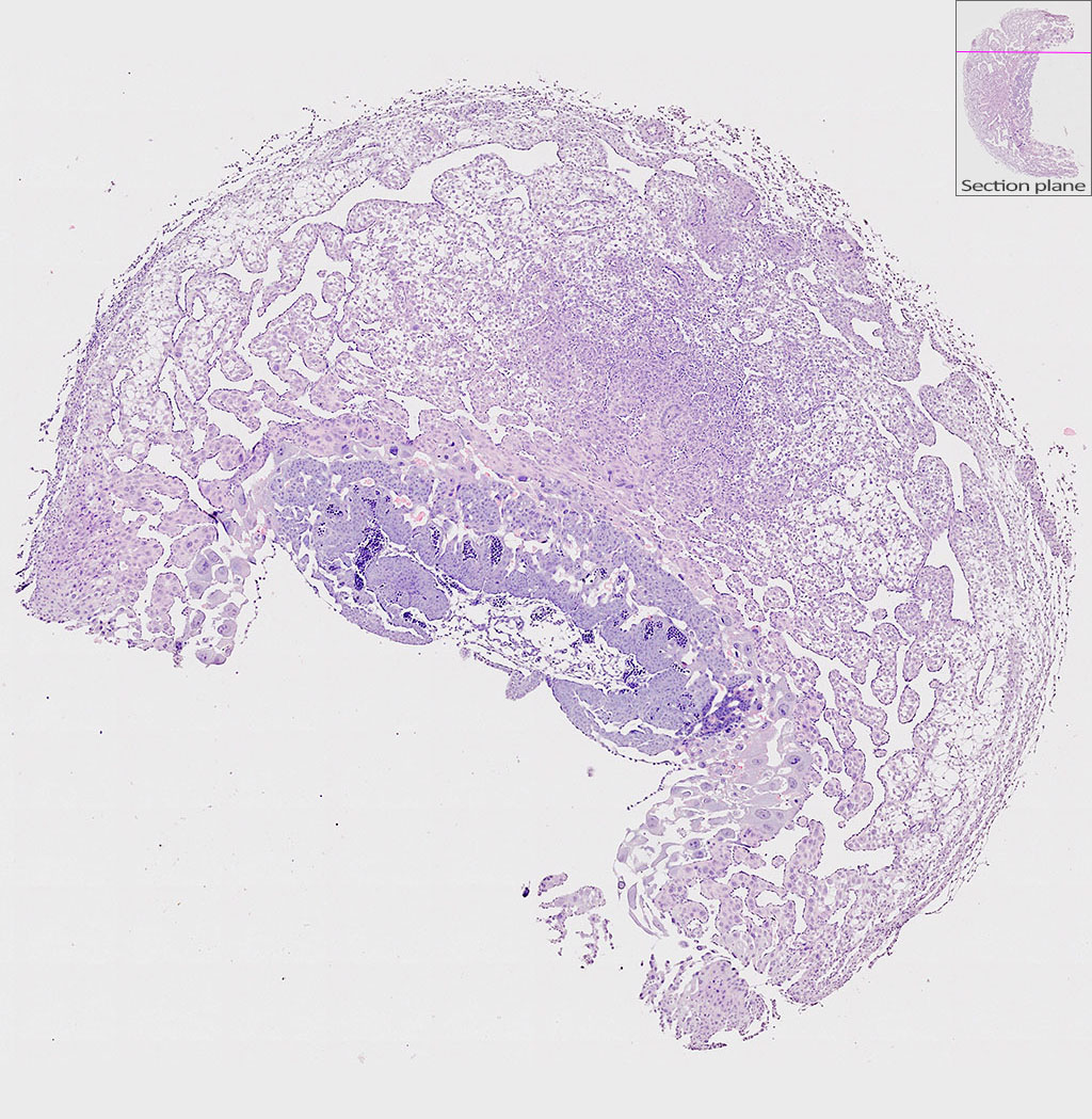 e9.5 mouse placenta