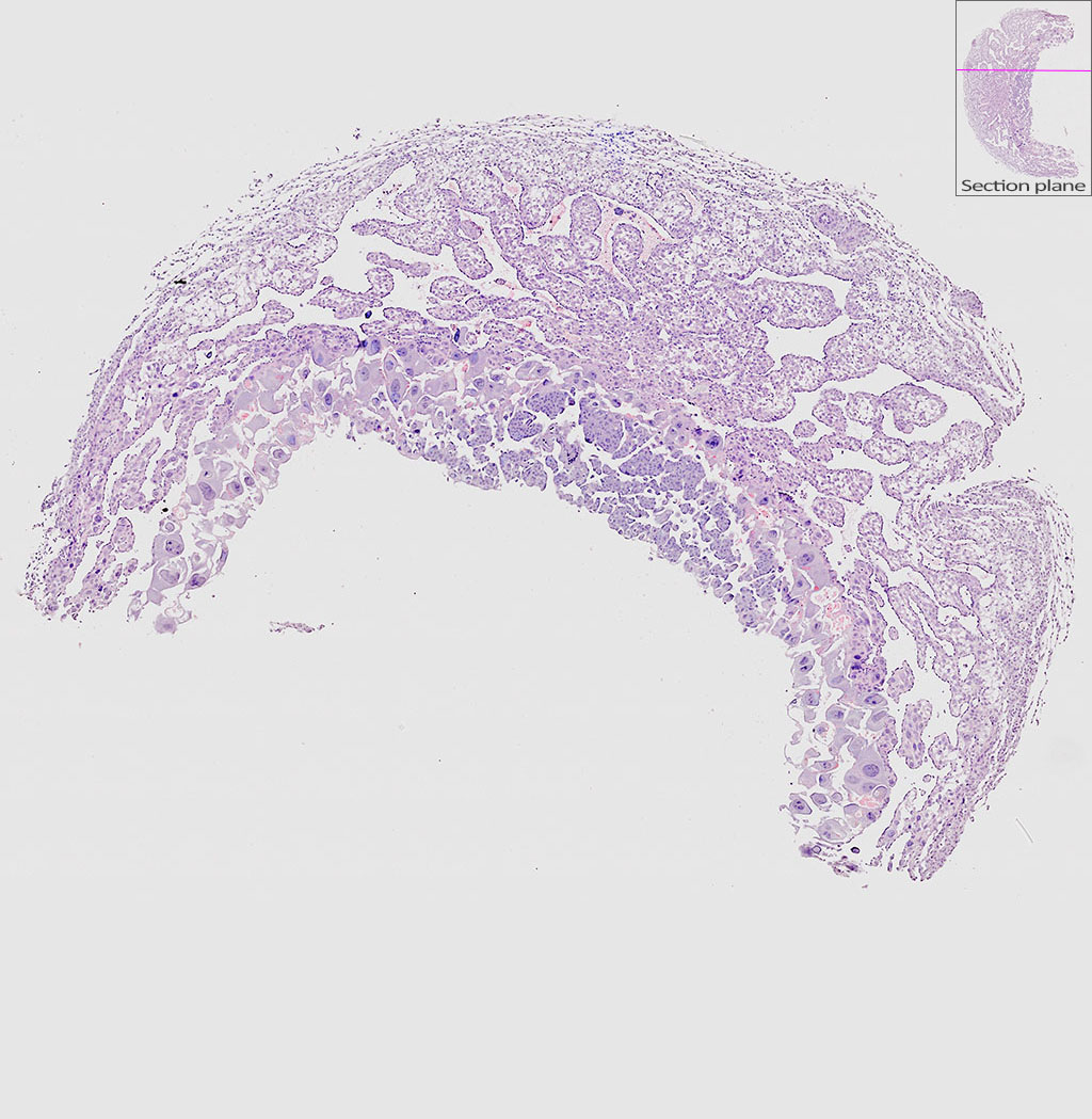 e9.5 mouse placenta