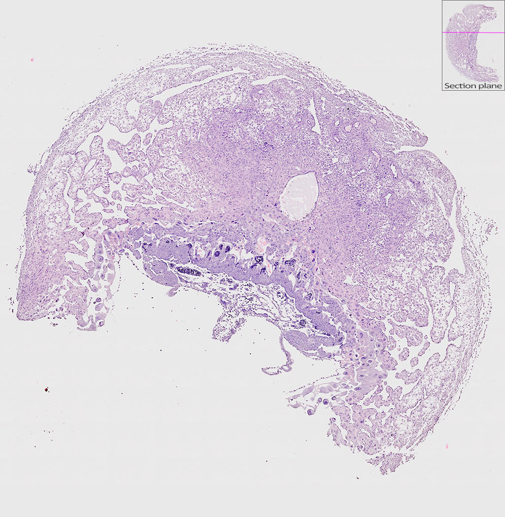 e9.5 mouse placenta