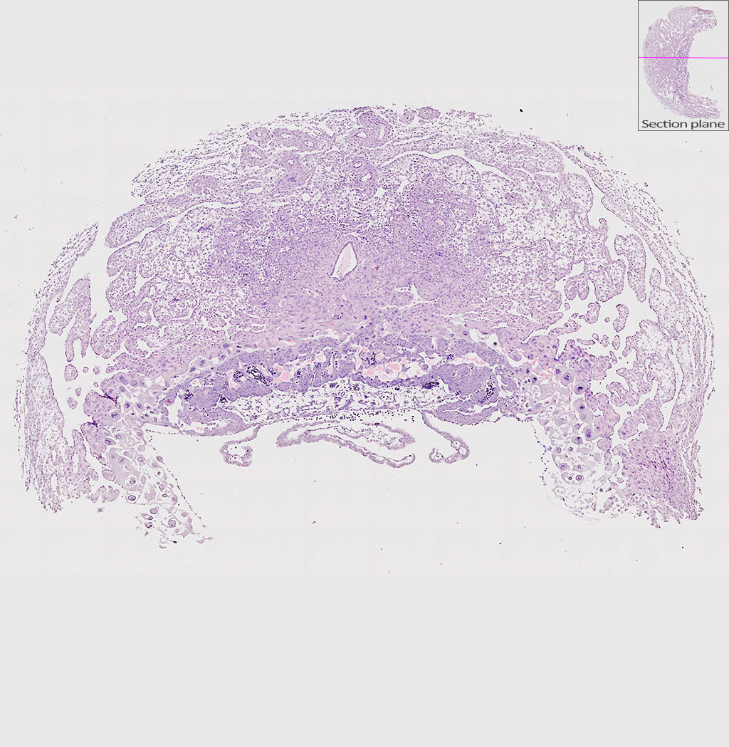 e9.5 mouse placenta