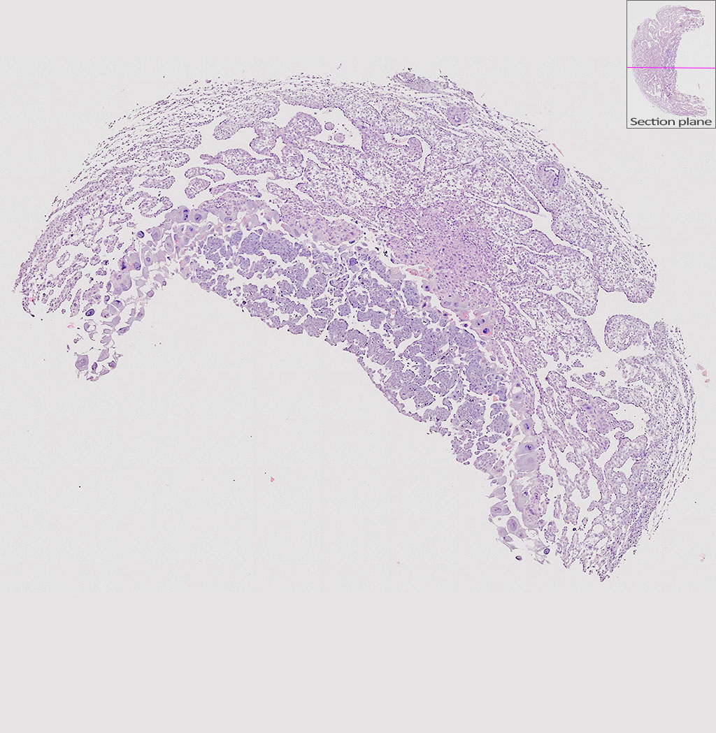 e9.5 mouse placenta