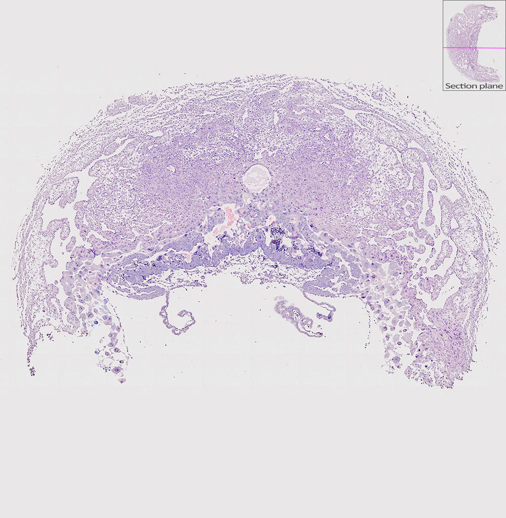 e9.5 mouse placenta