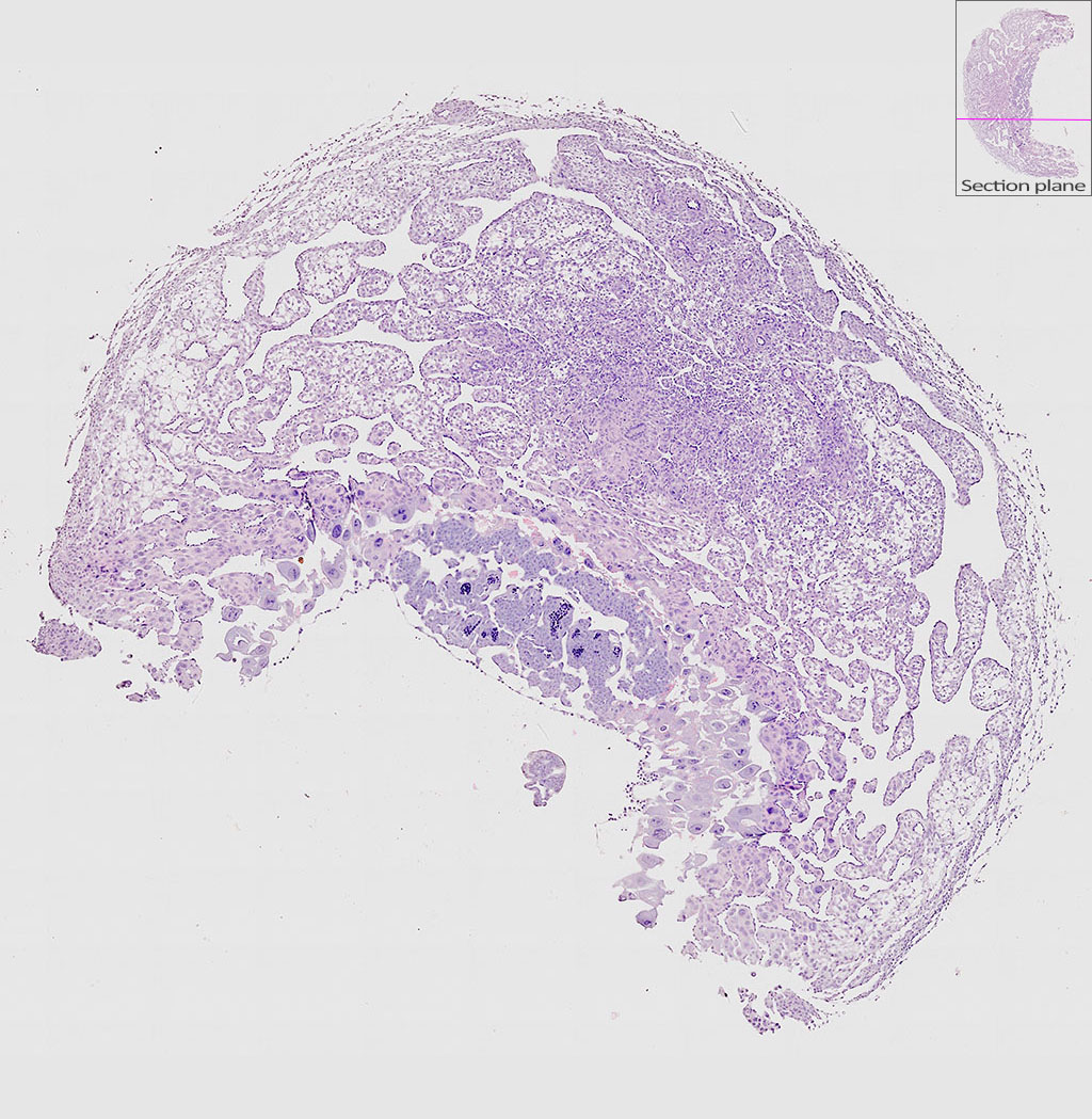 e9.5 mouse placenta