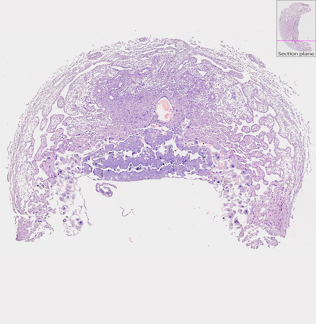 e9.5 mouse placenta