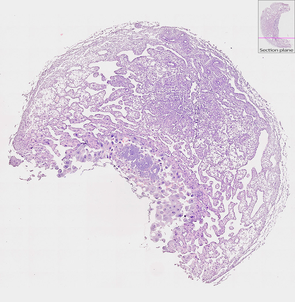 e9.5 mouse placenta