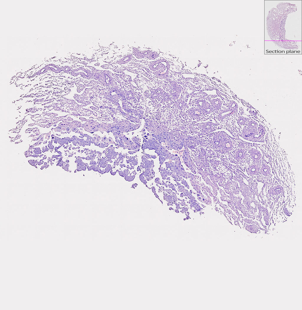 e9.5 mouse placenta